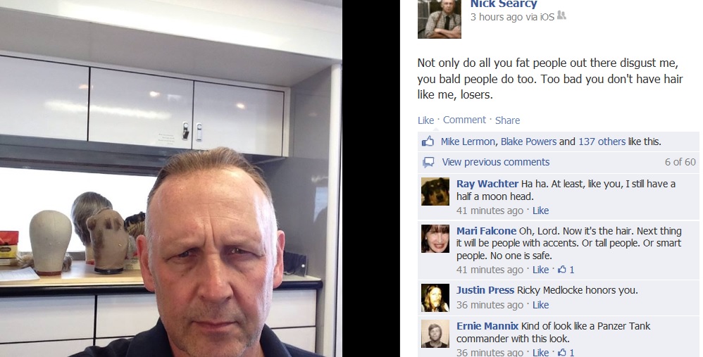 Nick Searcy hates bald people