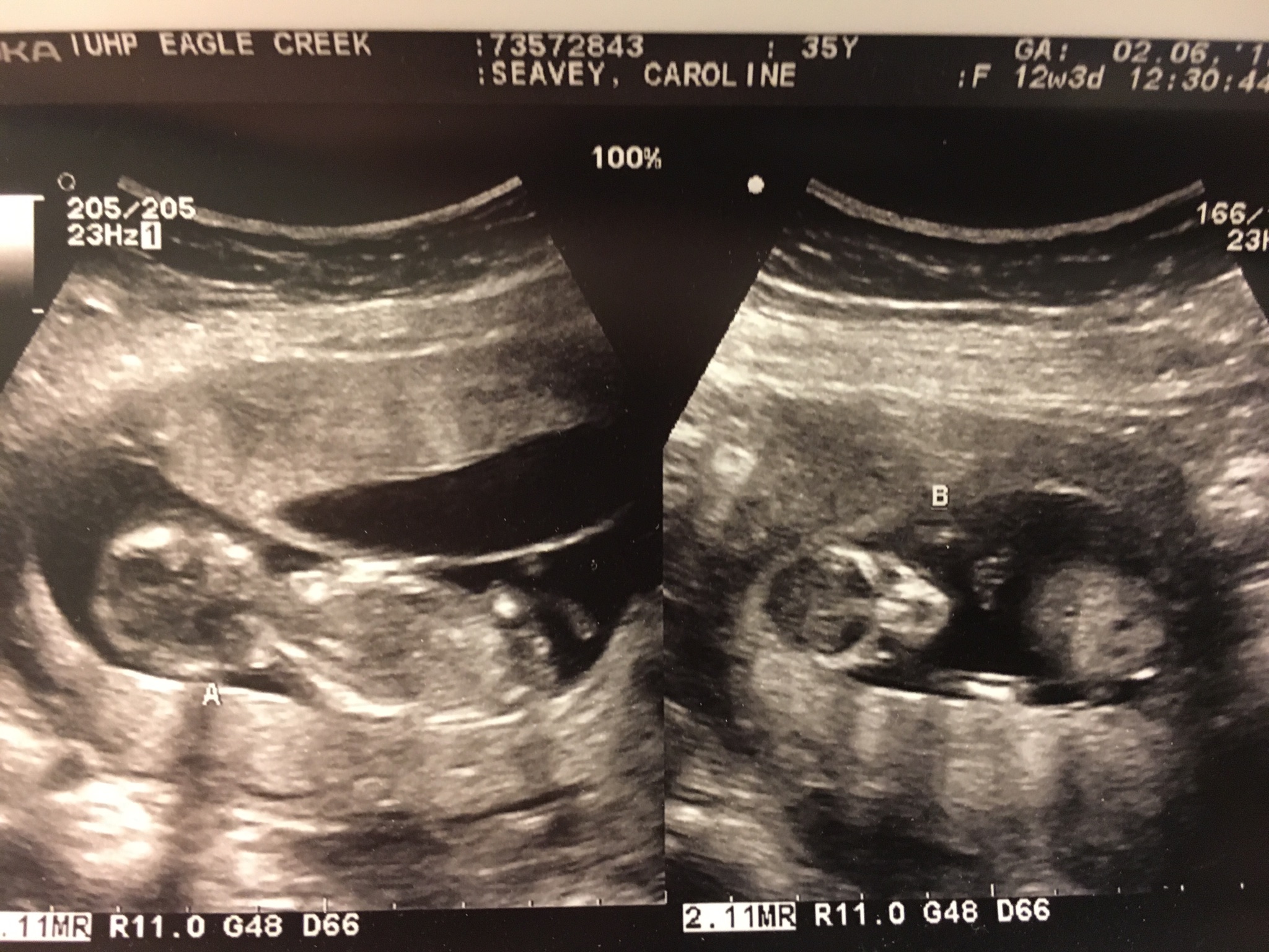 Guest post: On line baby shower for Mr. & Mrs. TSO