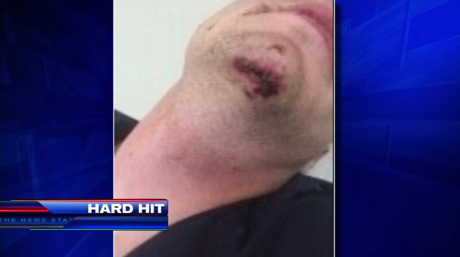 Marine War Veteran Sucker-Punched